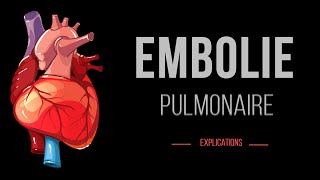 Embolie Pulmonaire  Cardiologie Urgence  Détails [upl. by Docilu]