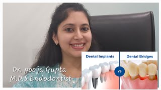 Dental Implant Vs Dental BridgeFixed Treatment option for missing teethDr Pooja Gupta [upl. by Polk]