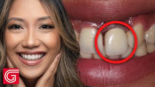 HOW TO Place BruxZIr® Esthetic ANTERIOR Bridge on Teeth 8 11 [upl. by Banwell806]