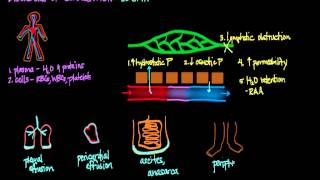 Disorders of Circulation Edema [upl. by Marianne737]