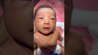 Respiratory Distress nicu medical baby viral [upl. by Malia]