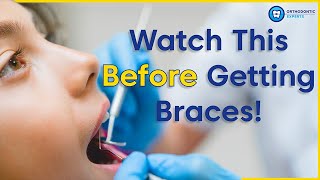 What To Know Before Getting Braces  8 Tips To Prepare You For Braces [upl. by Juster]