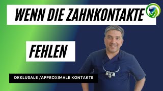 Wenn die Zahnkontakte fehlen oder zu stark sind  okklusale und approximale Kontaktpunkte [upl. by Onitsoga]