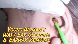 Young Womans Waxy Ear Cleaning amp Earwax Removal [upl. by Moreen]