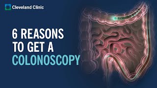 6 Reasons to Get a Colonoscopy [upl. by Southard]