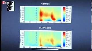 Schizophrenie  Was passiert im Kopf [upl. by Soloman]