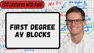 First Degree AV Block  Day 4 ECG Challenge [upl. by Suivatnod809]