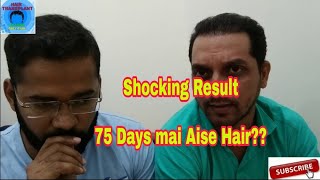 Rich Feel Patient Review of Best Hair Transplant Result  Doing ReSurgery in The Hair and shape [upl. by Nahej560]