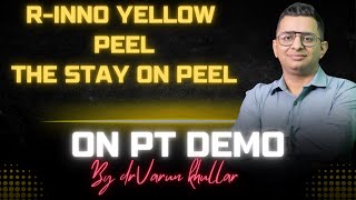 RINNO YELLOW PEEL STAY ON PEEL FOR GLOW On patient demo by DR VARUN KHULLAR MBBS MD [upl. by Dolli]