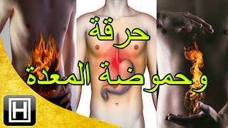 علاج حرقة المعدة والحموضة طبيعيا وبأفضل وأسهل الوصفات [upl. by Atteynad914]