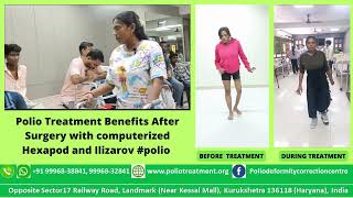 Polio Treatment Benefit after surgery with computerized Hexapod and Ilizarov polio poliotreatment [upl. by Schofield873]