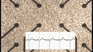 Beating Cardiomyocytes [upl. by Reynolds92]