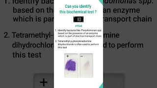 Quiz6Biochemical test for identification of bacteriashorts shortsfeed basicappliedmicrobiology [upl. by Ayeki]