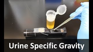 Urine Specific Gravity Refractometer [upl. by Dori654]