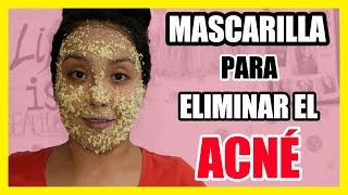 MASCARILLA de AVENA para ELIMINAR el ACNÉ  Mascarillas Naturales  Nadia Elias [upl. by Evonne]