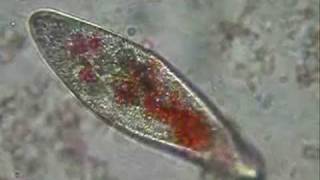 Paramecium eating pigmented yeast [upl. by Dunkin]