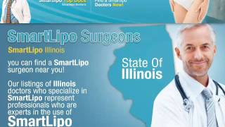 Smart Lipo Top Docs Illinois [upl. by Ireva]