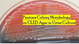 Characterizing Pantoea Colony Morphology on CLED Agar in Urine Culture [upl. by Modestia]