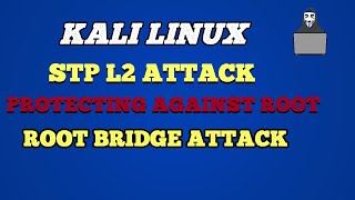 Kali Linux  STP L2 Attack and Protecting Against Root Bridge Attack [upl. by Healey]