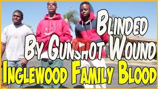 Munchie B from Inglewood Family Bloods lost vision after getting shot in head pt1of2 [upl. by Sprague]