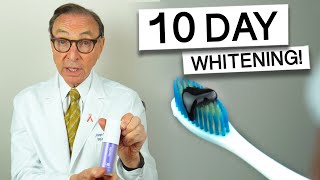 Hismile Purple Toothpaste for 10 Days  Dentist Review teethwhitening [upl. by Ardnahc876]