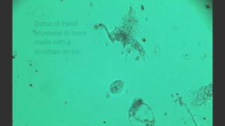 amoeba dictyostelium spore release [upl. by Nesto698]