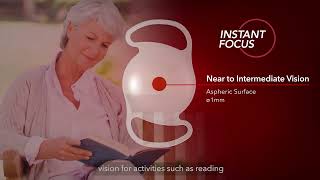 INSTANT FOCUS™  the Ultimate EDOF IOL Technology [upl. by Ewall]