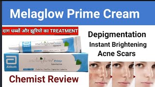 Melaglow Prime Cream Review l Melaglow Prime Cream Uses in Urdu hindi [upl. by Filipe]