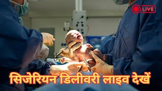 Live Cesarean Delivery  Cesarean Child Birth [upl. by Yelyak]