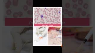 Peripheral blood film examination [upl. by Loriner657]