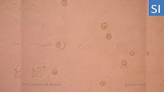 Unsporulated oocyst of coccidia [upl. by Anatak]