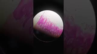 Histological slide of tongue showing filiform and fungiform papillae [upl. by Ramhaj]