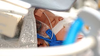 Common Neonatal Procedures  ETT  Surfactant Administration  Chest tube insertion [upl. by Arne]