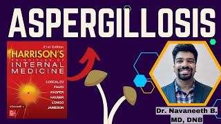 ASPERGILLOSIS  Pathogenesis  Clinical Features  Diagnosis  Treatment  Harrison [upl. by Ahsatsan495]