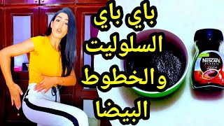 جلدك هيرجع بحال الأطفال😍🤩 حل الخطوط البيضاء وتمدد الجلد للأبد 🎁 [upl. by Manda719]