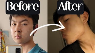 How I Got a STRONG Jawline as a SkinnyFat Guy [upl. by Nalepka113]