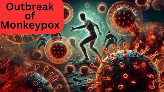 Outbreak of Monkeypox monkeypoxnews explained [upl. by Harmonie]