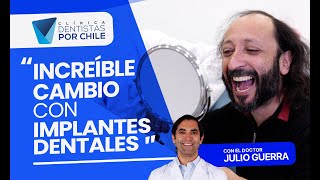 🦷 Testimonio de Cristian Renovando su sonrisa con implantes dentales implantesdentales saludbucal [upl. by Daune]