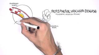 Cardiovascular Disease Overview [upl. by Laforge]