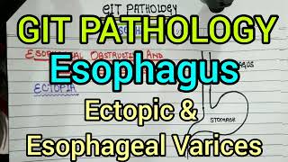 Ectopia amp Esophageal Varices  GIT Pathology [upl. by Macey]