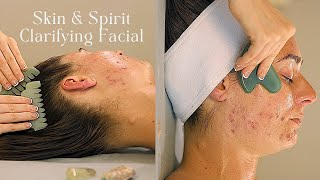 Clarifying Acne Facial Natural Rituals for Clear Skin  Spirit Care [upl. by Aiciruam]