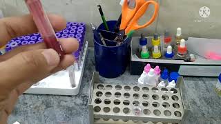 Direct coomb test procedure  coomb test  antiglobulin test [upl. by Ydnal24]