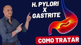 H PYLORI X GASTRITE Como Tratar  Dr Moacir Rosa [upl. by Aihsemaj763]