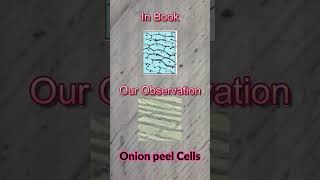 Cells Under Microscope Ovum Cells Muscle Cells Onion Peel Cells and Blood Cells  LP [upl. by Anirrok973]