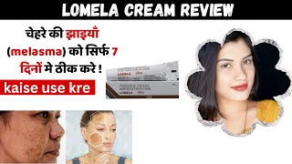 Lomela Cream Ke Fayde Aur Nuksan  Hydroquinone Tretinoin amp Mometasone Furoate Cream  how To Use [upl. by Gregson]