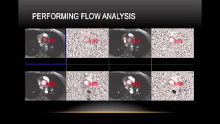 MRI Flow and Function [upl. by Anujra]