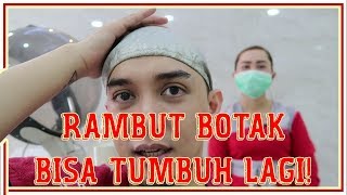 INI LOH TERNYATA PENYEBAB RAMBUT BOTAK  Part 1  Ichsan Akbar [upl. by Akinnej]