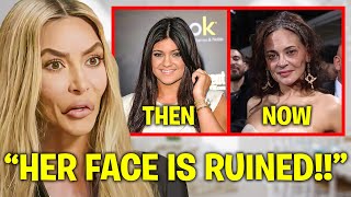 Kim Kardashian EXPOSES Kylie Jenner’s BOTCHED Plastic Surgery [upl. by Hinckley]