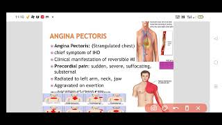 What is Angina Pectoris Types of Angina Pathophysiology of angina [upl. by Yentruok]