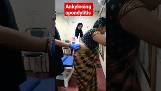 Ankylosing spondylitis treatment 93085113578409313131 drrajneeshkant [upl. by Thirzi]